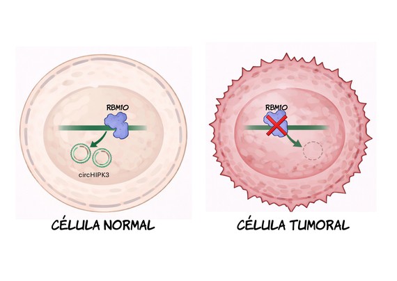 Una pista para frenar el cáncer de pulmón: cómo RBM10 influye en ARN circulares que limitan el crecimiento tumoral